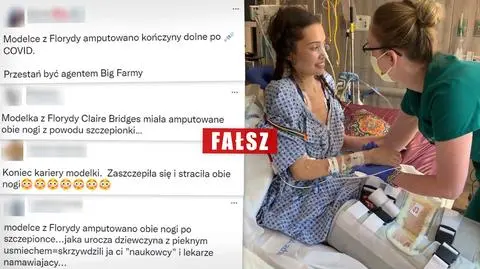 Modelka z Florydy "zaszczepiła się i straciła obie nogi"? To nieprawda, powód był inny