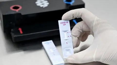 Czym jest transmisja pozioma i dlaczego nie tym, o czym mówi minister?