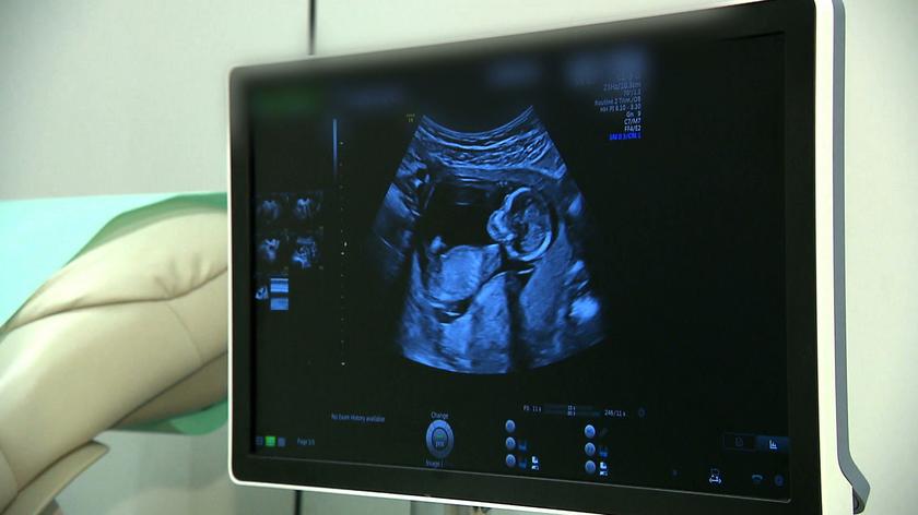 25.10.2020 | "Nie wiadomo, czy w ogóle będą badania prenatalne. Jaki jest ich sens?"