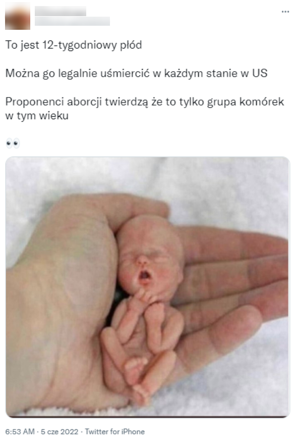 fremsætte anden Rykke Zdjęcie płodu w 12. tygodniu ciąży? Nie, to powracający antyaborcyjny wiral  - Konkret24